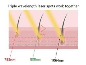  Laser à diodes pour épilation / FG2000-D 