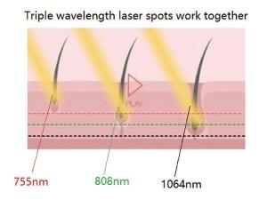  Laser à diodes pour épilation/ FG2000-B 